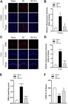 Echinocystic acid alleviated hypoxic-ischemic brain damage in neonatal mice by activating the PI3K/Akt/Nrf2 signaling pathway